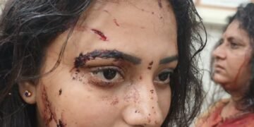 విశాఖలో దారుణం… టీడీపీకి ఓటేశారని దాడి