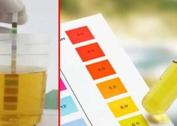 మూత్రం పసుపు రంగులో వస్తుందా?